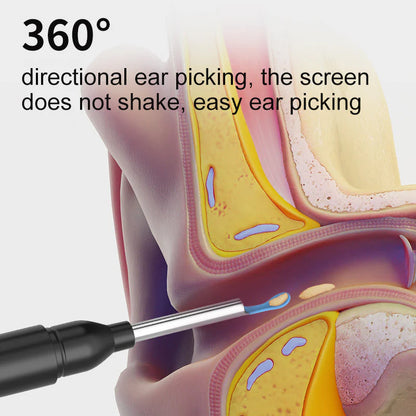 Visual Smart Ear Cleaner